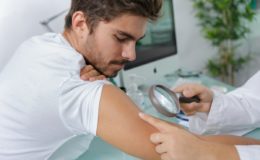 cauze de aparitie pentru alunite