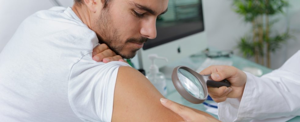 cauze de aparitie pentru alunite